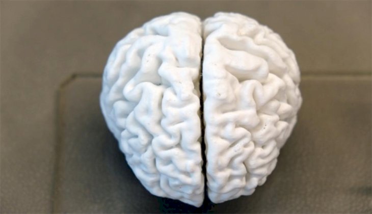 Türkiye’de ilk kez yaşayan bir insan beyninin 3D kopyası yapıldı