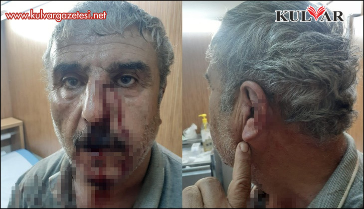 Acıpayam'da Doktor ile emekli öğretmenin mesai kavgası karakolda bitti