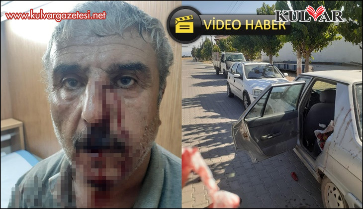 Emekli öğretmen, doktor ile aralarında Acıpayam'da yaşanan mesai kavgasının detaylarını anlattı