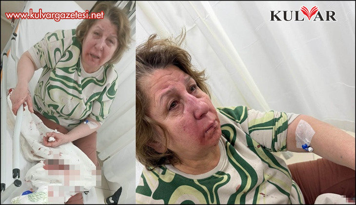 Sarayköy'de komşusunu darp eden sivil memur hakkında soruşturma açıldı